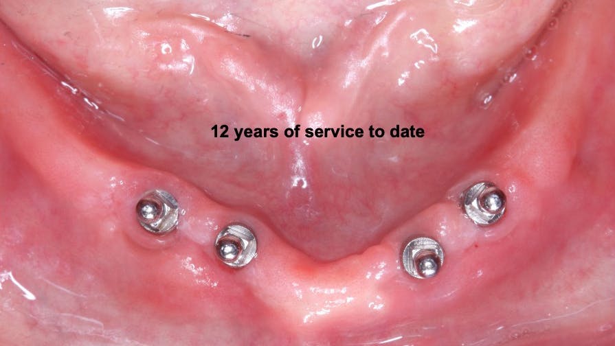 restorative-dentistry