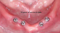 restorative-dentistry restorative-dentistry