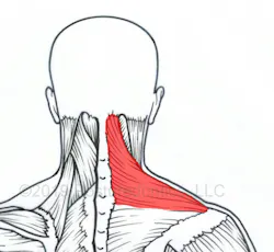 Figure 1: The trapezius muscle Figure 1: The trapezius muscle