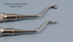 Figure 4: Placing pressure on the palate with this device or any small object causes blanching, reduced blood supply, and usually a painless injection if administered as described in this article. Figure 4: Placing pressure on the palate with this device or any small object causes blanching, reduced blood supply, and usually a painless injection if administered as described in this article.