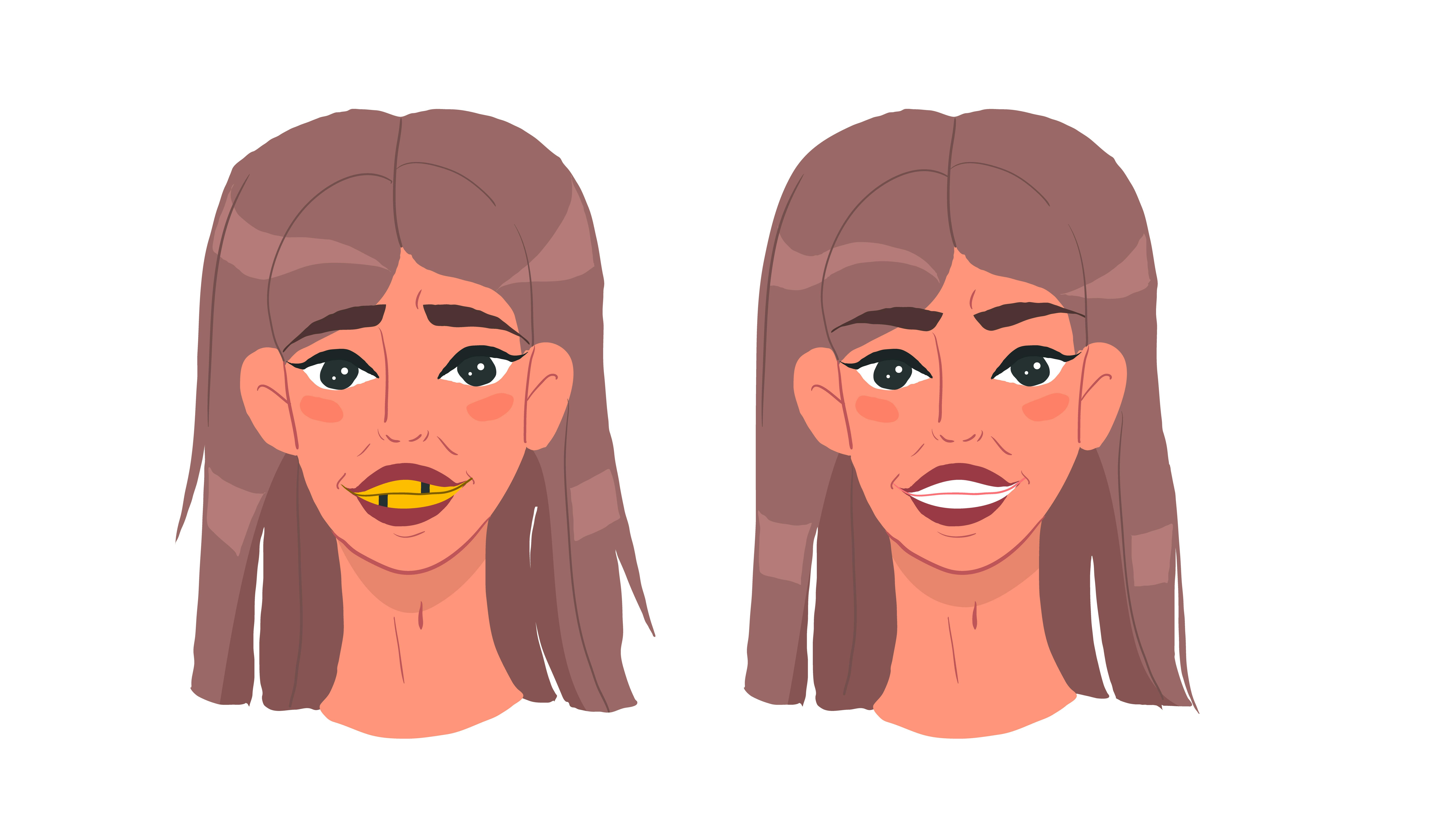 Quality before-and-after photos are great marketing tools for your dental practice.