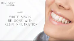 White spots be gone with resin infiltration with Dr White spots be gone with resin infiltration with Dr