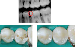 dental products dental products