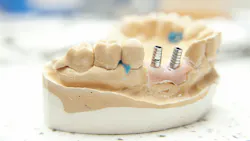 67c64161c5e80d1735ecd96a Gettyimages182166877 67c64161c5e80d1735ecd96a Gettyimages182166877