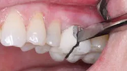 680f90118d73de0c38c5d478 Primary 680f90118d73de0c38c5d478 Primary