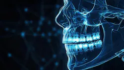 Glowing x-ray image of skull Glowing x-ray image of skull