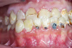 Figure 1: Rapid decay Figure 1: Rapid decay