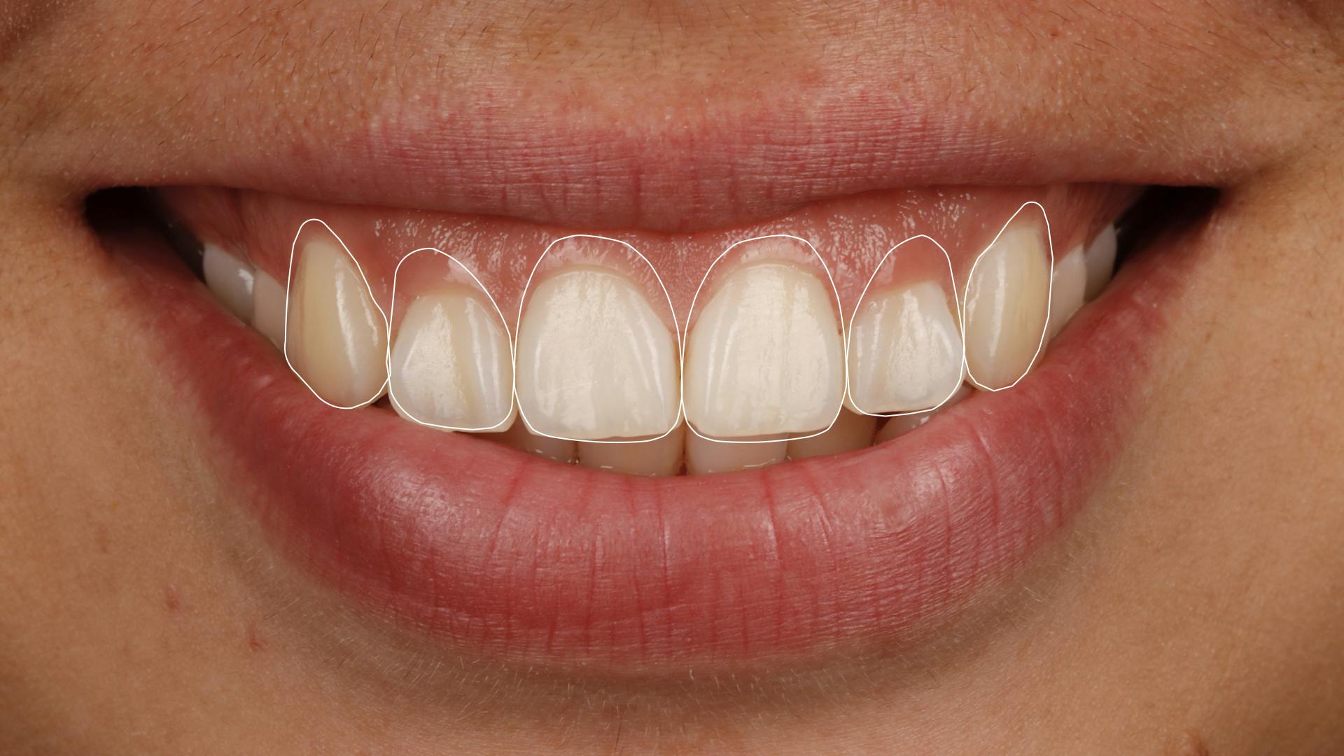 a smile with teeth outlined