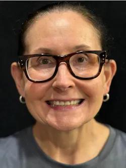 full-face photo of a dental patient full-face photo of a dental patient