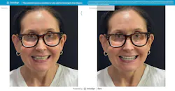 digital tool simulating a dental patient's new smile digital tool simulating a dental patient's new smile