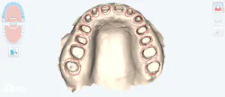 stone model of teeth stone model of teeth