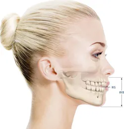 illustration analyzing facial balance as it relates to speech, TMJ, etc. illustration analyzing facial balance as it relates to speech, TMJ, etc.