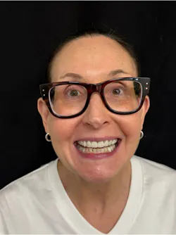 full-face photo of a dental patient with a big smile full-face photo of a dental patient with a big smile