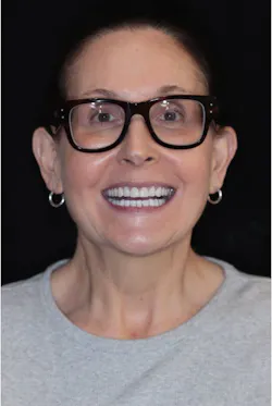 full-face photo of a dental patient with a nice smile full-face photo of a dental patient with a nice smile