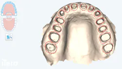 stone model of teeth stone model of teeth