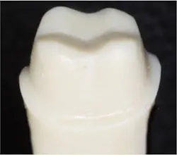 tooth preparation tooth preparation