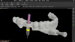 dental surgical guide design dental surgical guide design