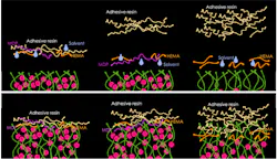 Figure 1: Components of a universal (left), self-etch (middle), and total-etch (right) bonding agent before (top) and after (bottom) application to the tooth. The green lines represent collagen, and the pink circles represent hydroxyapatite crystals. Figure 1: Components of a universal (left), self-etch (middle), and total-etch (right) bonding agent before (top) and after (bottom) application to the tooth. The green lines represent collagen, and the pink circles represent hydroxyapatite crystals.
