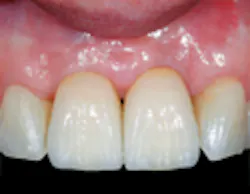 BioHorizons-2 BioHorizons-2