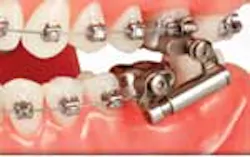 Content Dam Diq Online Articles 2012 June Advansync2 Es Content Dam Diq Online Articles 2012 June Advansync2 Es