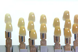 Content Dam Diq Online Articles 2015 01 Shade Guide Content Dam Diq Online Articles 2015 01 Shade Guide