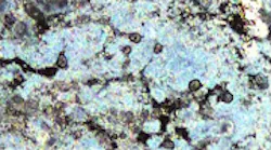 Periodontitis biofilm Periodontitis biofilm