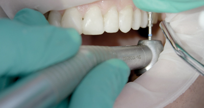 Content Dam Diq Online Articles 2015 04 Aurum