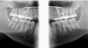 Content Dam Diq Online Articles 2015 07 15july2bcdennehy Article Thumbnail