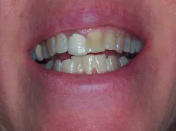 13decbfssegal01 13decbfssegal01