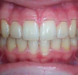 13decbfssegal02cropped 13decbfssegal02cropped