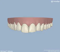 13decbfssegal03 13decbfssegal03