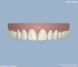 13decbfssegal04 13decbfssegal04