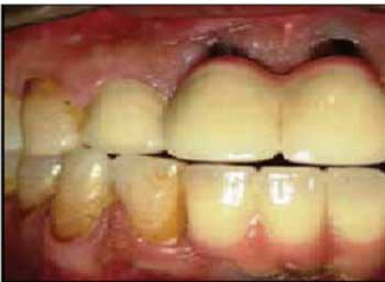 13deccrawfordparycbct01