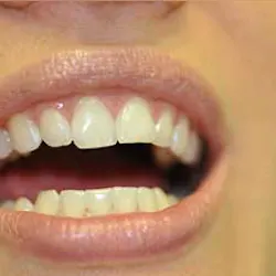 14apr17bfsperronehawley01 14apr17bfsperronehawley01