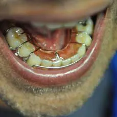 14apr17bfsperronehawley05 14apr17bfsperronehawley05