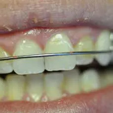 14apr17bfsperronehawley10 14apr17bfsperronehawley10