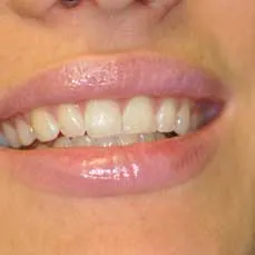 14apr17bfsperronehawley11 14apr17bfsperronehawley11