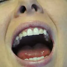 14apr17bfsperronehawley12 14apr17bfsperronehawley12