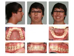 14aug21bfssimmons01 14aug21bfssimmons01