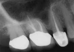 14jul15endolandwehr6morecall2 14jul15endolandwehr6morecall2