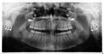 14jul17orthosimmons01