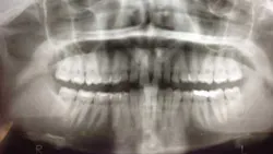 14jul17orthosimmons03 14jul17orthosimmons03