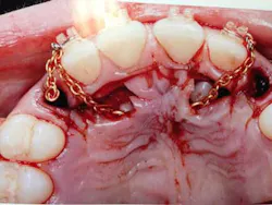 14jul17orthosimmons05 14jul17orthosimmons05