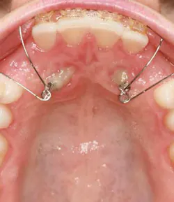 14jul17orthosimmons07 14jul17orthosimmons07