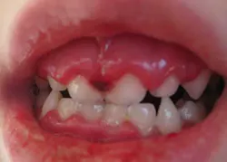 14junesimmonsaphg02 14junesimmonsaphg02