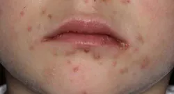 14junesimmonsaphg03 14junesimmonsaphg03