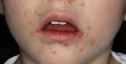 14junesimmonsaphg04 14junesimmonsaphg04