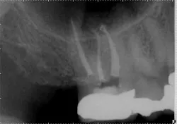 15jan20endolandwehr02 15jan20endolandwehr02