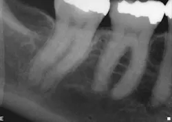 15jan20endolandwehr03 15jan20endolandwehr03