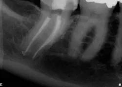 15jan20endolandwehr04 15jan20endolandwehr04